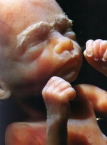 Двадцать четвертая неделя беременности
