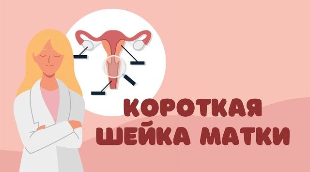Короткая шейка матки при беременности: диагностика и лечение