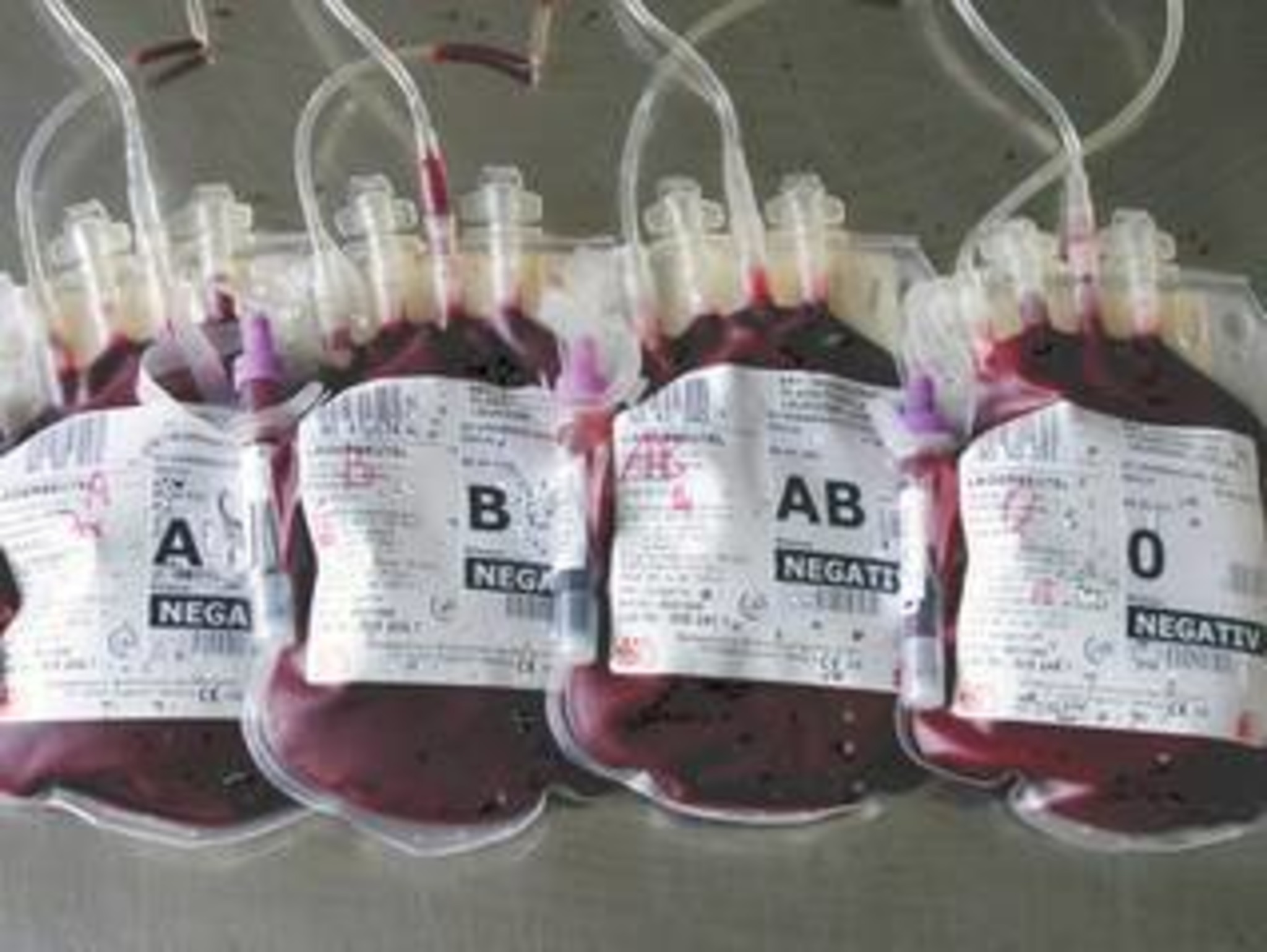 Какие анализы проводят перед плановым переливанием цельной донорской крови и компонентов, содержащих эритроциты