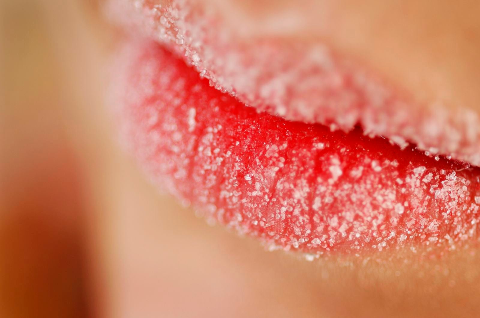 Обветренные губы, что делать при обветривании губ?