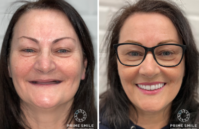 Московская стоматология Prime Smile: Ваша улыбка в надежных руках!