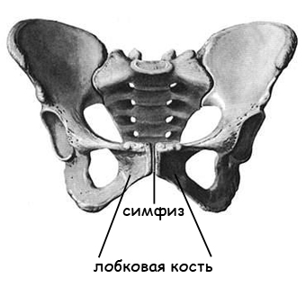 Симфизит и беременность