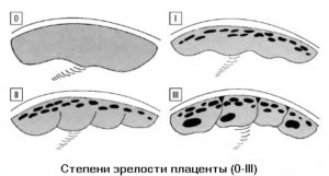 Зрелость плаценты